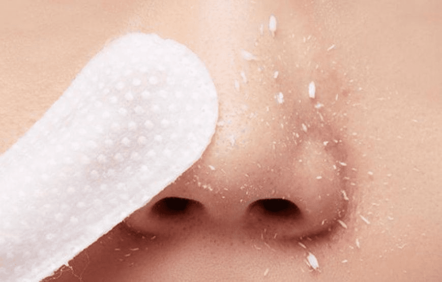 A’pieu Goblin Blackhead Peeling Pad Пилинг пэды против черных точек, 9 гр